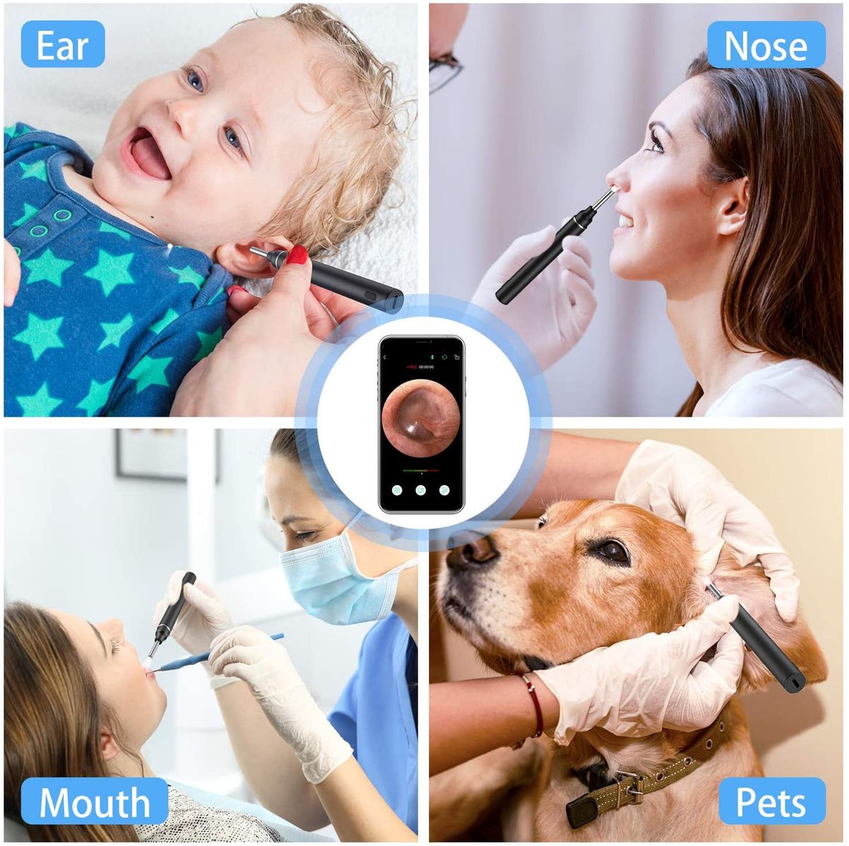 VITCOCO 5.5mm Digital 720P HD WiFi Otoscope Ear Camera with 6 LED Lights, Earwax Remover for iPhone/iPad/iOS/Android, Black-1